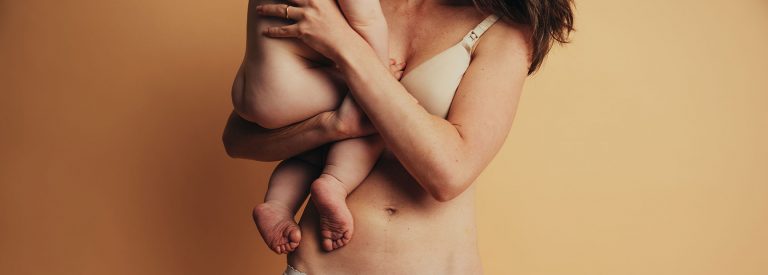 Traitement post grossesse avec la radiofréquence - Aesthemedica Paris